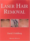 Laser Hair Removal